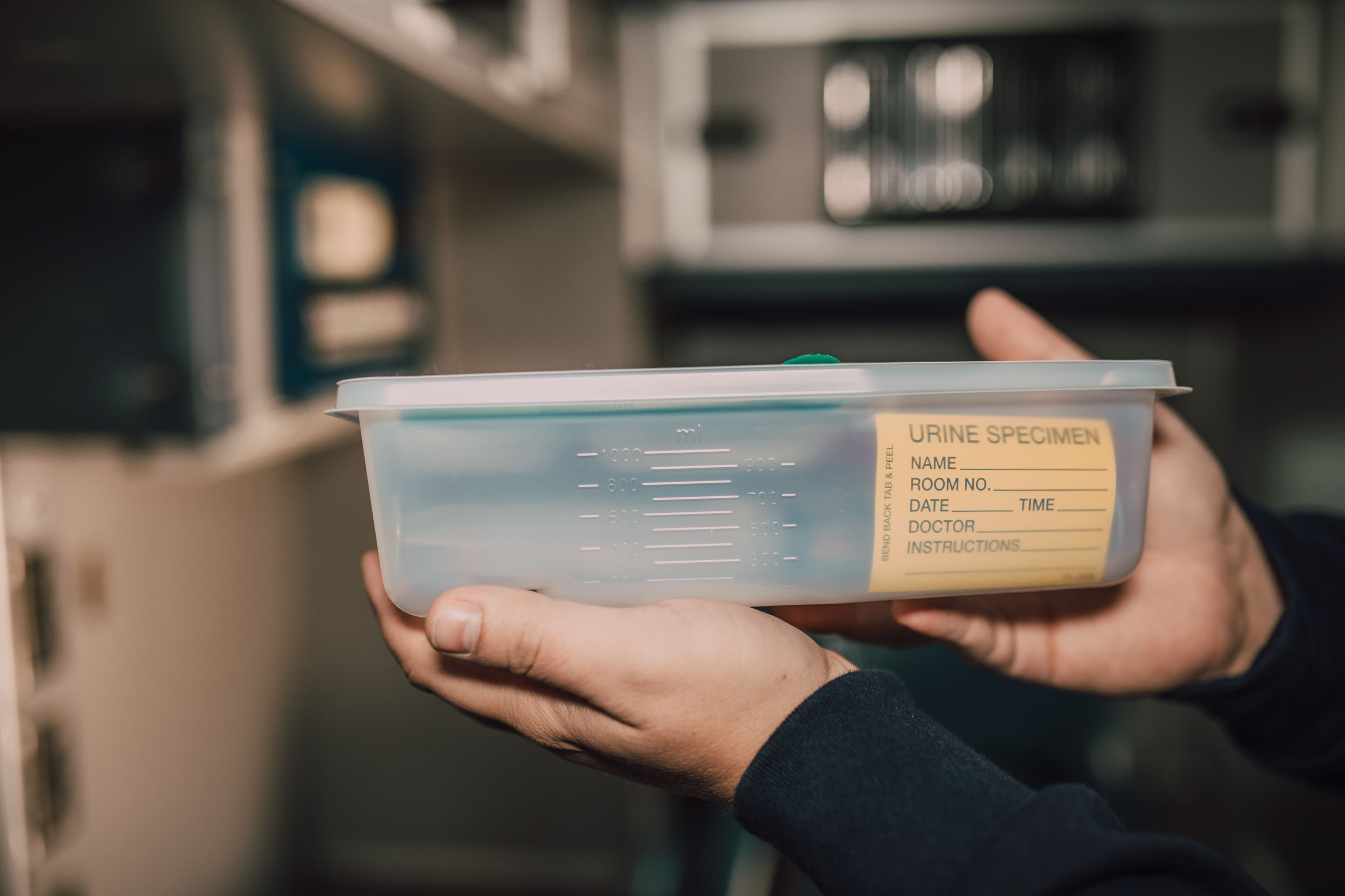 Sealed urine sample container