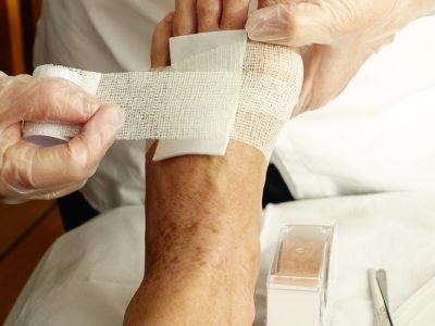 Nurse,Bandaging,Or,Dressing,A,Wound,In,Home,Enviroment.,Home