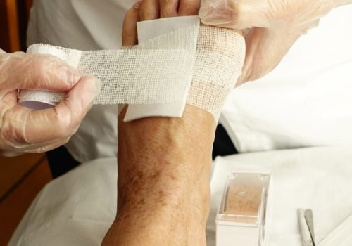 Nurse,Bandaging,Or,Dressing,A,Wound,In,Home,Enviroment.,Home
