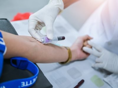 Close,Up,Hand,Of,Nurse,,Taking,Blood,Sample,From,A