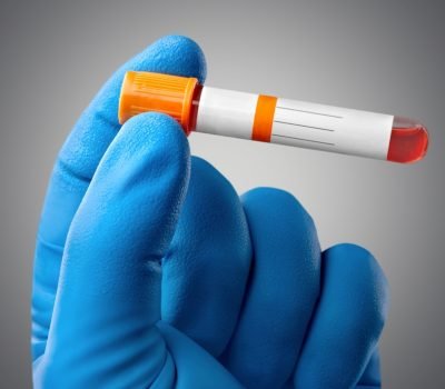 Blood,Sample,Tubes,In,Hand,,Medical,Concept